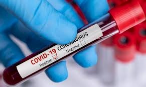 Coronavirus Update : चरम पर पहुंचा कोरोना वायरस, देश में अब तक 37.66 लाख मामले, जानिए राज्यों का हाल